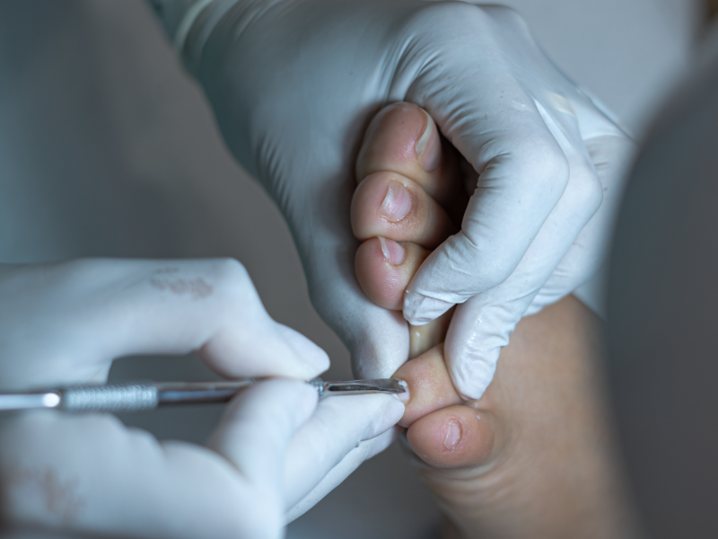 Detalle del cuidado de las uñas de los pies en Kiropedic