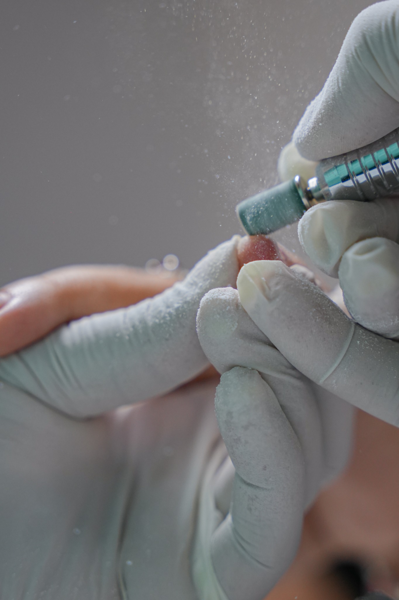 Cuidado profesional de las uñas de los pies en Kiropedic